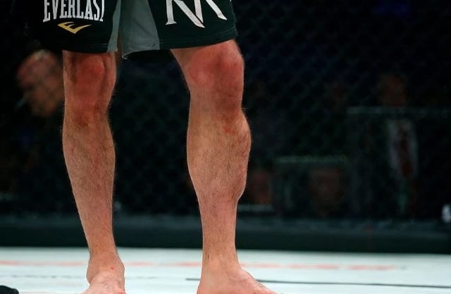 Rory-MacDonald-Leg.jpg