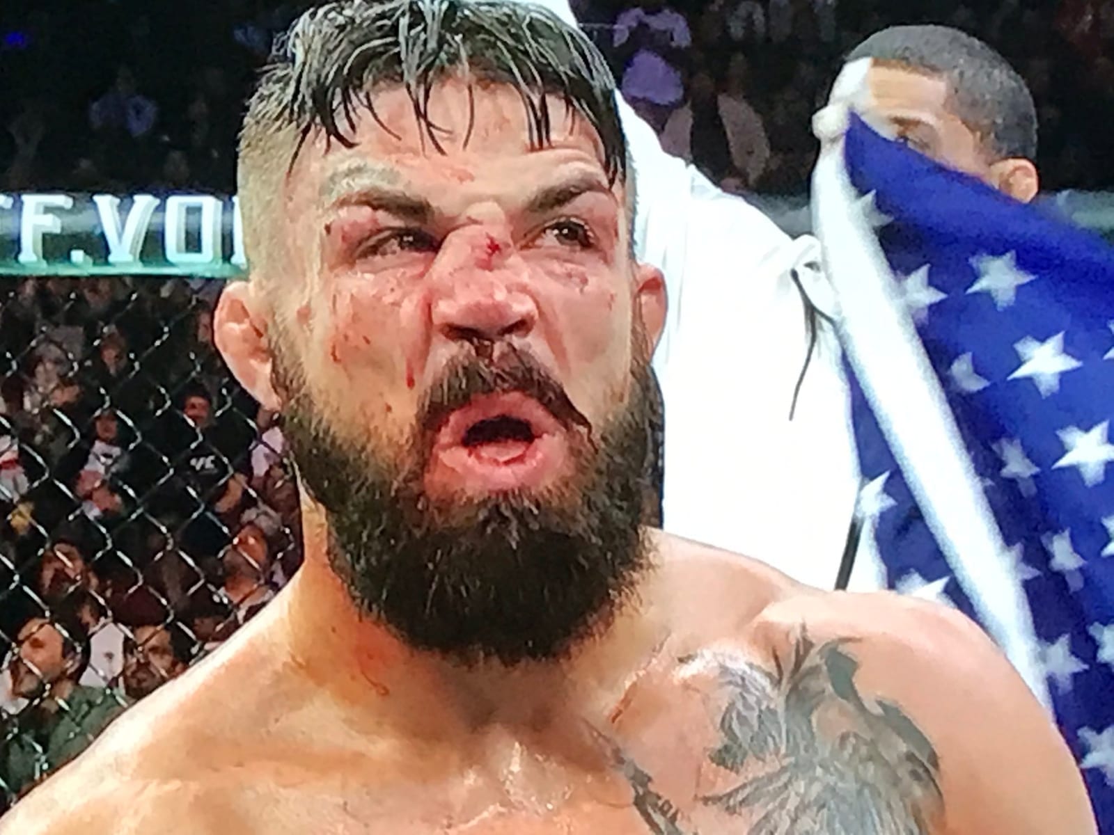 Ufc mike perry broken nose