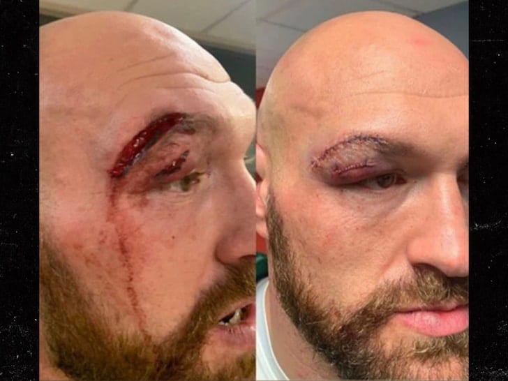 Tyson Fury gives cutman a bonus after horror cut in Las Vegas