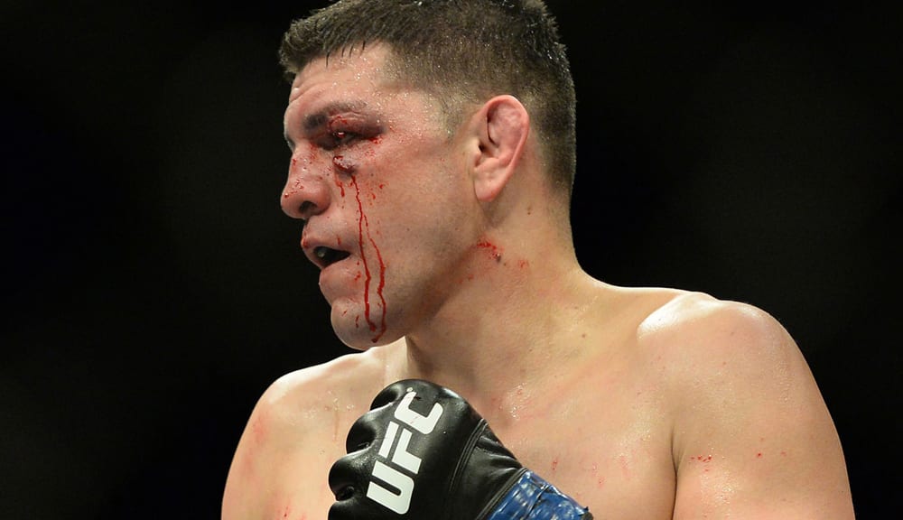 ‘I don’t think Nick should fight’: Dana White says Nick Diaz should walk away from fight game thumbnail